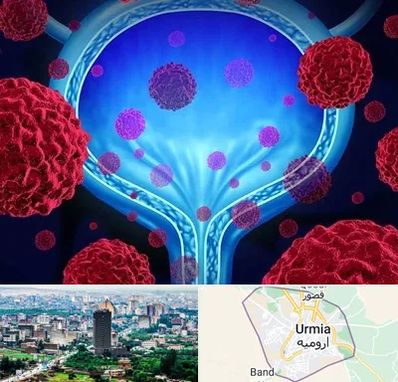 دکتر سرطان مثانه در ارومیه