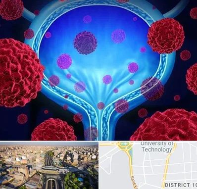 دکتر سرطان مثانه در استاد معین 