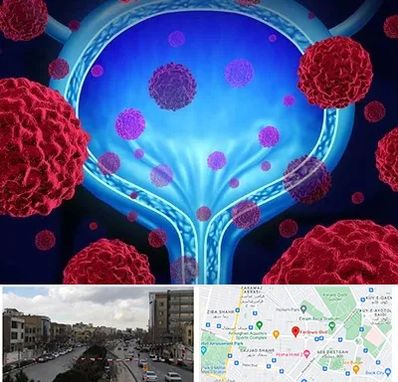 دکتر سرطان مثانه در بلوار فردوسی مشهد 