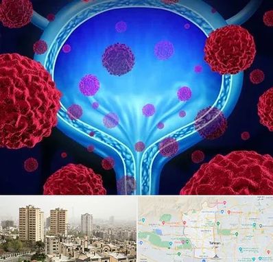 دکتر سرطان مثانه در منطقه 5 تهران 