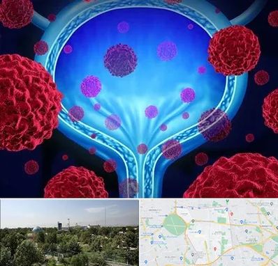 دکتر سرطان مثانه در منطقه 16 تهران 