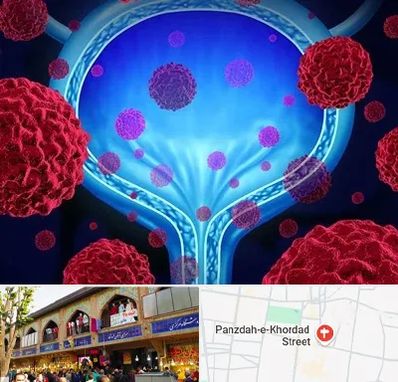 دکتر سرطان مثانه در 15 خرداد