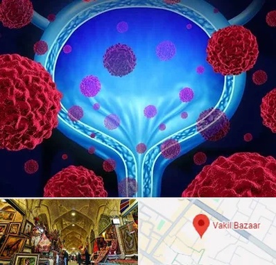 دکتر سرطان مثانه در بازار وکیل شیراز