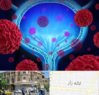 دکتر سرطان مثانه در لاله زار