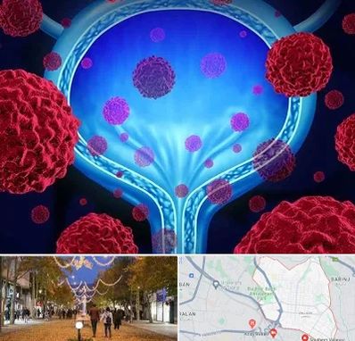 دکتر سرطان مثانه در ولیعصر ارومیه