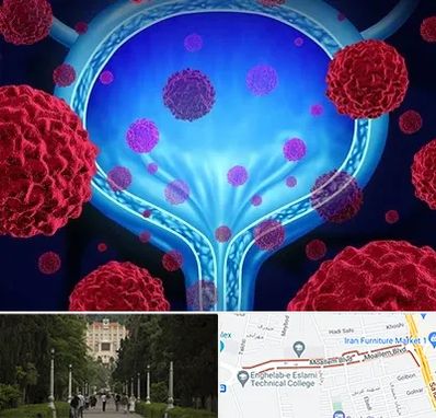 دکتر سرطان مثانه در بلوار معلم رشت 