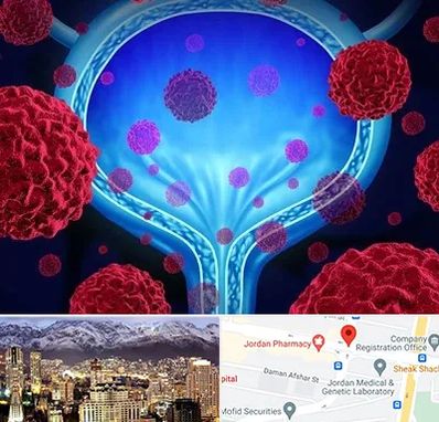 دکتر سرطان مثانه در جردن 