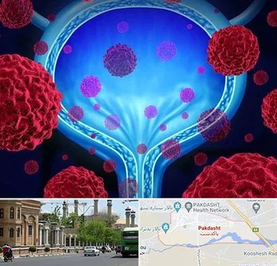 دکتر سرطان مثانه در پاکدشت