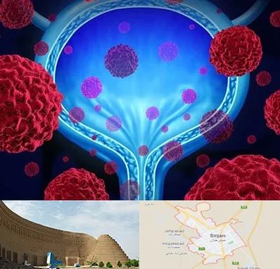 دکتر سرطان مثانه در سیرجان