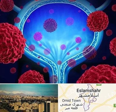 دکتر سرطان مثانه در اسلامشهر