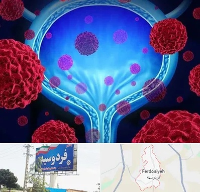 دکتر سرطان مثانه در فردوسیه شهریار