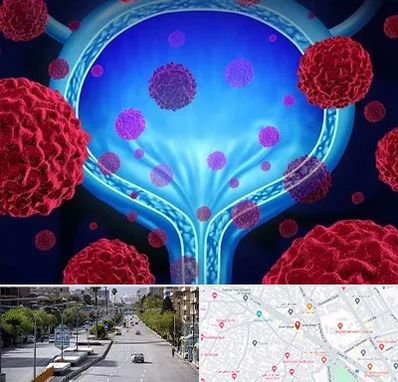 دکتر سرطان مثانه در خیابان زند شیراز 