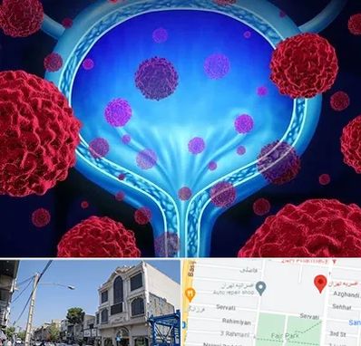 دکتر سرطان مثانه در افسریه 