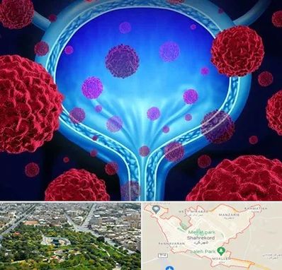 دکتر سرطان مثانه در شهرکرد