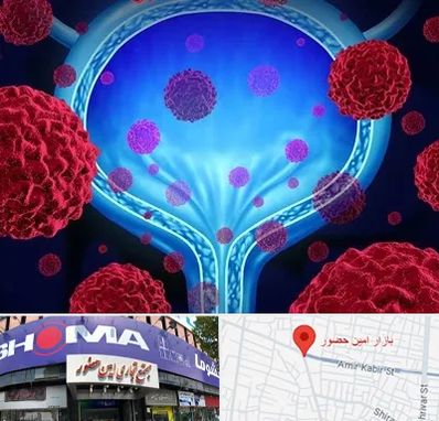 دکتر سرطان مثانه در امین حضور