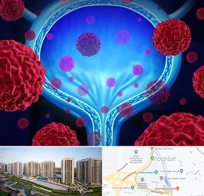 دکتر سرطان مثانه در المپیک 