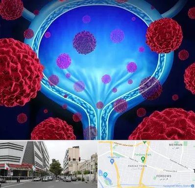 دکتر سرطان مثانه در بلوار فردوس 