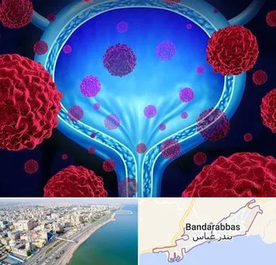 دکتر سرطان مثانه در بندرعباس