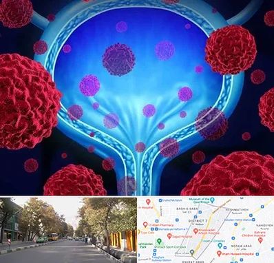 دکتر سرطان مثانه در شریعتی 