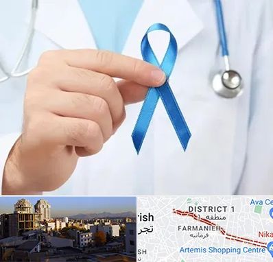 دکتر سرطان بیضه در فرمانیه 