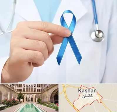 دکتر سرطان بیضه در کاشان
