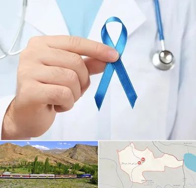 دکتر سرطان بیضه در خاش