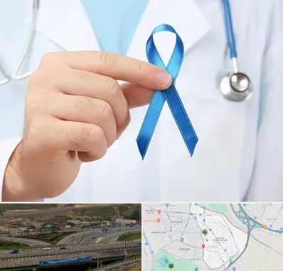 دکتر سرطان بیضه در یاغچیان تبریز