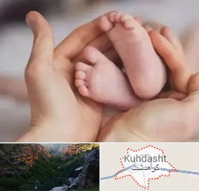 دكتر ناباروری در کوهدشت