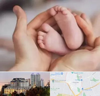 دكتر ناباروری در فرشته 