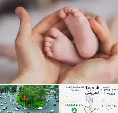 دكتر ناباروری در تجریش 