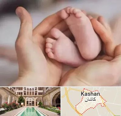 دكتر ناباروری در کاشان