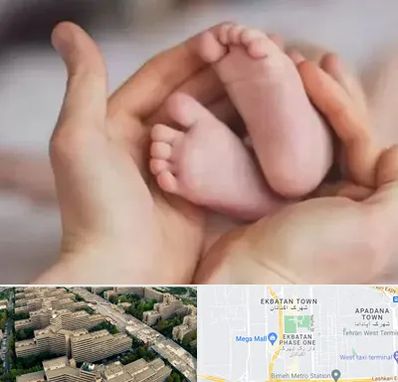 دكتر ناباروری در اکباتان 