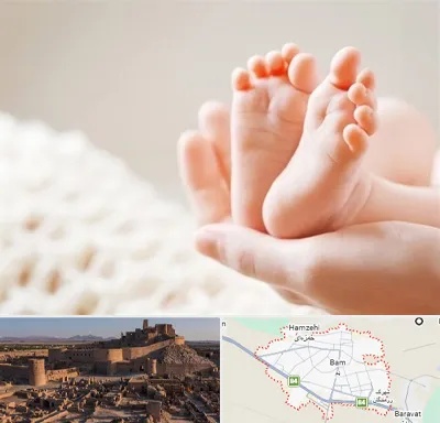 دكتر نازایی در بم