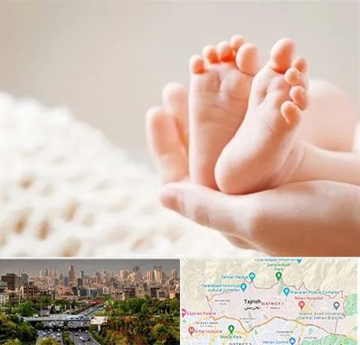 دكتر نازایی در منطقه 1 تهران 