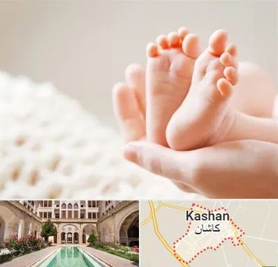 دكتر نازایی در کاشان