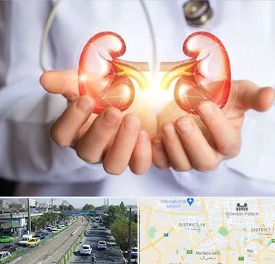 دکتر اورولوژی کودکان در جنوب تهران 