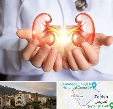 دکتر اورولوژی کودکان در زعفرانیه 