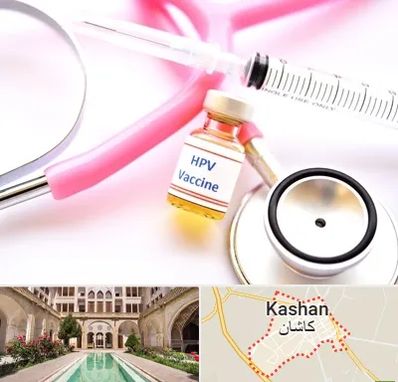 واکسن زگیل تناسلی HPV در کاشان