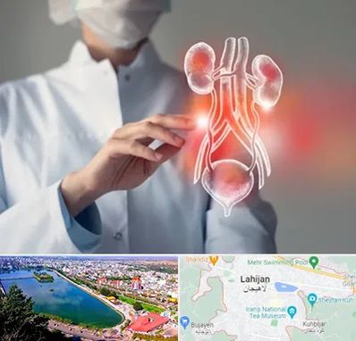 کلینیک اورولوژی در لاهیجان