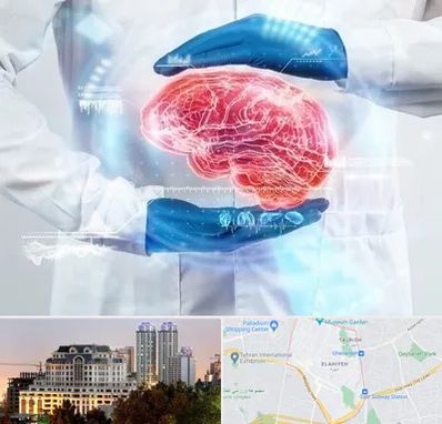 دکتر مغز و اعصاب در فرشته 