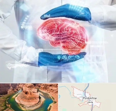 دکتر مغز و اعصاب در پلدختر