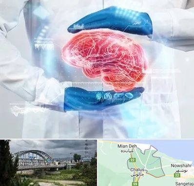 دکتر مغز و اعصاب در چالوس