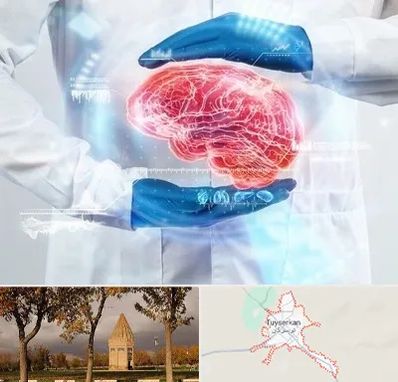 دکتر مغز و اعصاب در تویسرکان