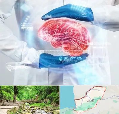 دکتر مغز و اعصاب در گلستان