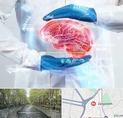 دکتر مغز و اعصاب در زرگنده