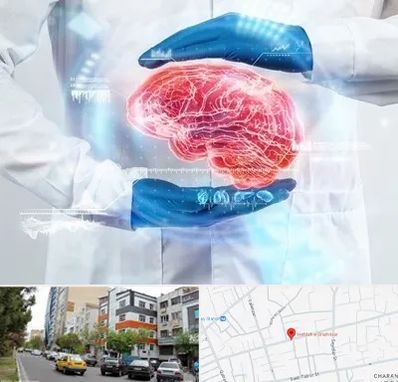 دکتر مغز و اعصاب در هفده شهریور تبریز