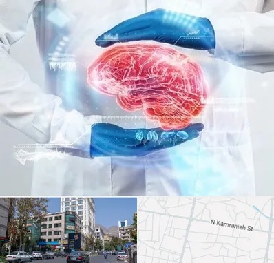 دکتر مغز و اعصاب در کامرانیه