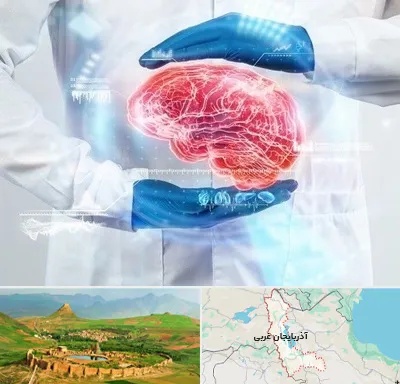 دکتر مغز و اعصاب در آذربایجان غربی