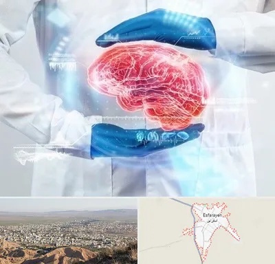 دکتر مغز و اعصاب در اسفراین