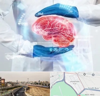 دکتر مغز و اعصاب در جوادیه